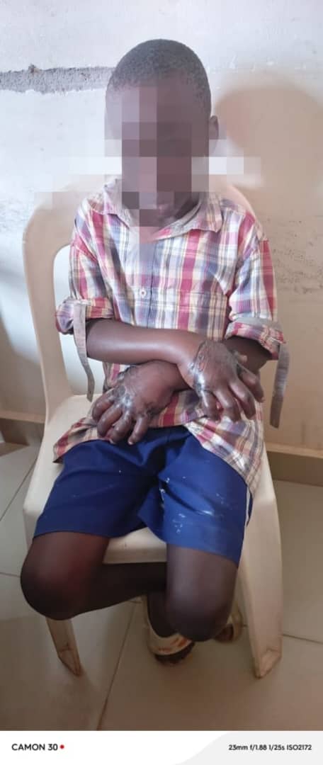 10-Year-Old Boy Brutally Tortured Over UGX 47,000 as Three Family Members Arrested in Wakiso