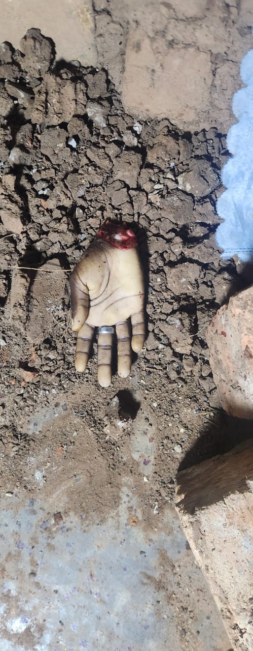 Shock in Wakiso as Homeowner Cuts Off Suspected Burglar’s Arm During Midnight Confrontation